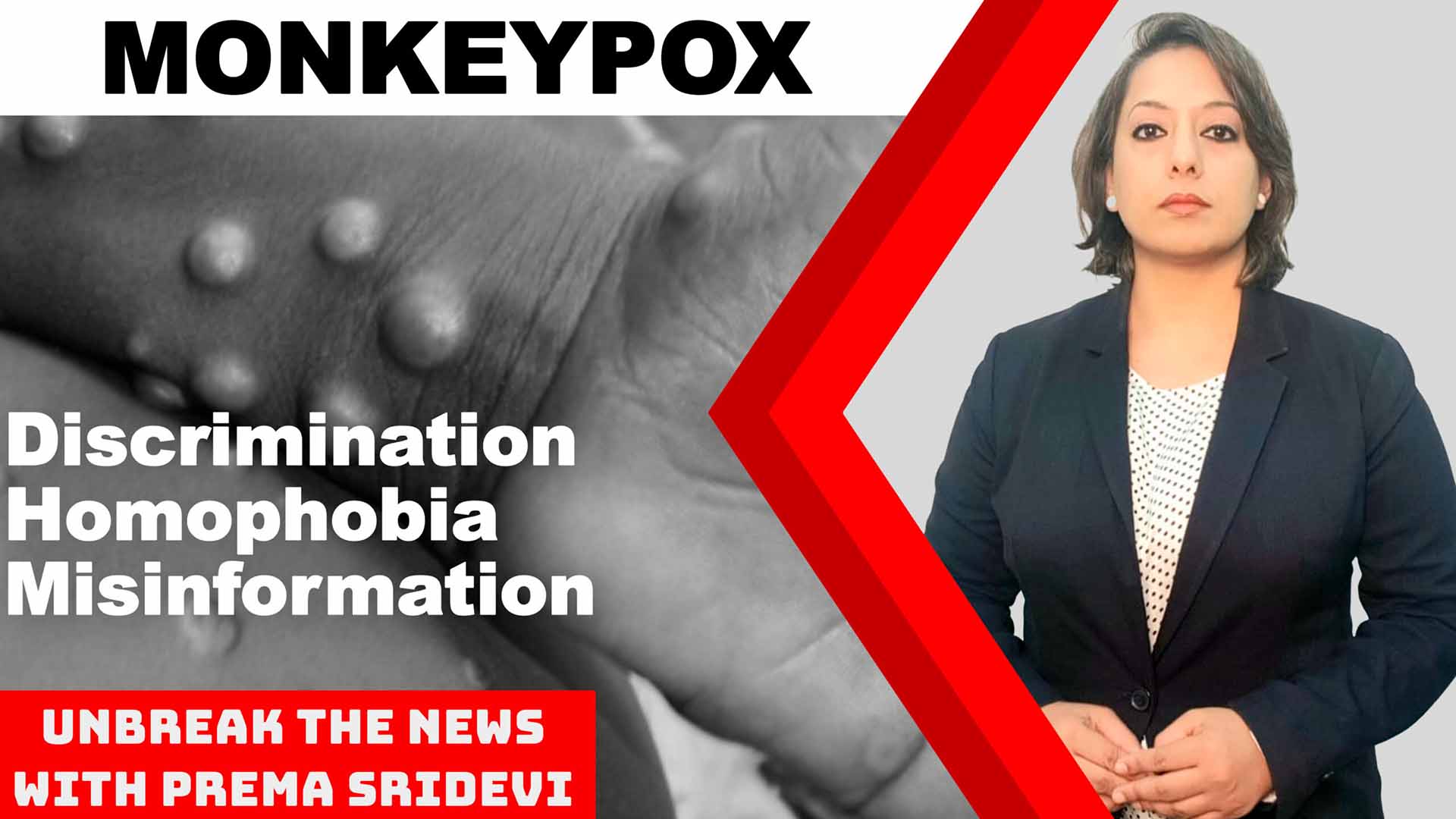 Monkeypox: Homophobia, discrimination, misinformation | Unbreak the News with Prema Sridevi Ep:59
